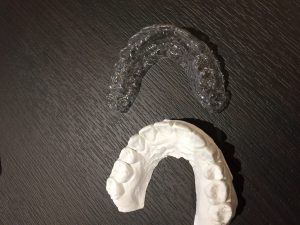 保定装置のマウスピース