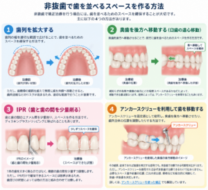非抜歯で歯を並べるスペースを作る方法