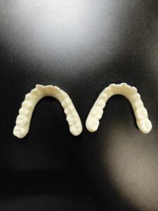 ３Dプリンターで作成された歯列模型