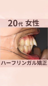 20代　女性　ハーフリンガル