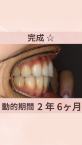 20代　女性　ハーフリンガル