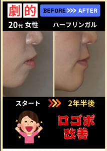 治療前後の変化