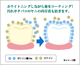 ホワイトニングしながら歯をコーティング！汚れやタバコのヤニの再付着も防ぎます。